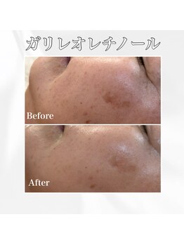 エレナ 伊勢崎(Ele'na)/ガリレオレチノール