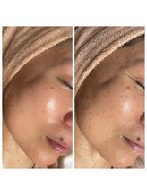 シャルナ(charna) サロンの こだわり