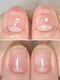 リモネイル(Rimo nail)の写真/爪の形にコンプレックスのある方、噛み癖・むしり癖のある方、形が丸い・平べったい方、お悩み解決します！