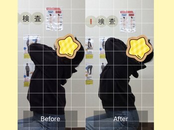 ナオル整体 春日部院(NAORU整体)/春日部/整体/猫背矯正/姿勢矯正