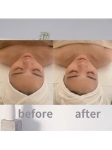 エルドットサナ(L.sana)/小顔マッサージ【初回】