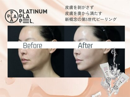 ルナビューティー 赤坂(LUNA beauty)の写真