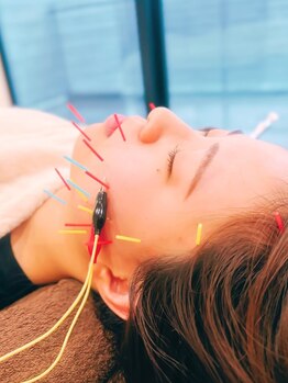 ミー(Mi)の写真/《小顔/リフトアップ》お悩み・状態の深さに合わせて、あなたに合ったエイジングケアを！