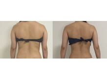 プリマルーチェ/プレミアム花嫁様プログラム