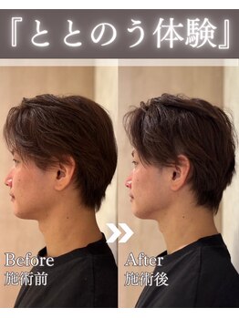 ルデュー 南青山本店(Ledieu)/巡りを整える美容鍼灸