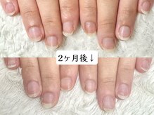 グレースレディ 神戸北店/