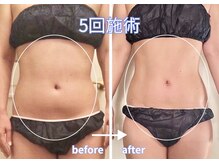 ゲットレディー 本店(GetLady)