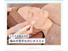 痛みが少ないシミケア。機械当て放題