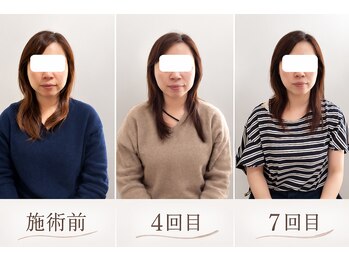 りんぱサロン まり/7回目までの変化