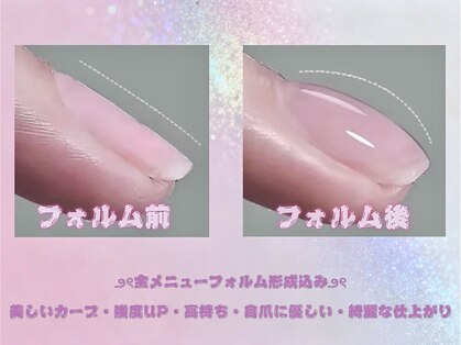 リン(Lynn)の写真