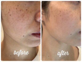 ビーフリー(Be free)/