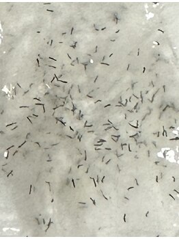 美肌ワークス(美肌works)/効果が見えるヒゲ脱毛