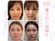 ハッピービューティーサロン じゆう(Happy Beauty Salon J∞YOU)の写真