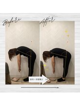 ラクリエ 東加古川院(La Creer)/お客様ビフォーアフター