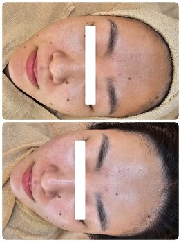 クレイルサロン(Claire salon)/ソフトハーブコース