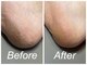 ロナネイル(RONA NAILS)の写真/【大人気★足裏つるつる角質ケア】ガサガサのかかと…タイツやストッキングの引っかかり気になりませんか？