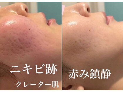 キュート 川越店(Cute)の写真