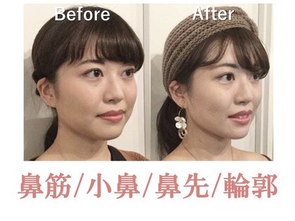 ラプリ 横浜店(Raplit)の写真