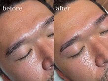 ハダケア(HADA CARE)/HBL（ハリウッドブロウリフト）