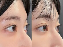 チェリッシュ 中川店(Cherish)/まつげパーマ