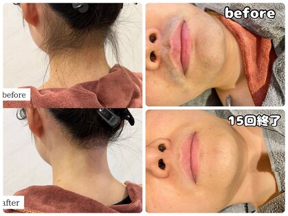 ワイズサロン(Y's salon)の写真