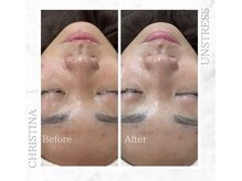 シャルムパリス(charme paris)/うる艶肌へ☆１回の施術変化