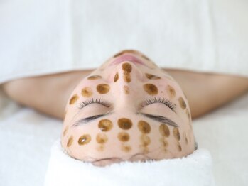 シャルトルズ 西宮北口店の写真/【赤み改善/ニキビケア◎ハーブピーリング・幹細胞入￥18500⇒￥9800】韓国アイドルのような艶肌に♪