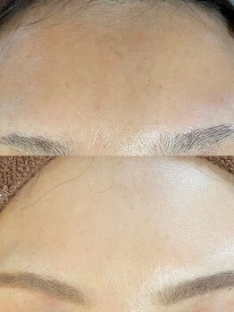 ユウビビューティサロン 東生駒(Yuubi Beauty Salon)/【peel stage】ハーブピーリング