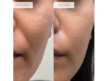 アンドニューリー(&NEWLY)/LDM×クリスティーナ