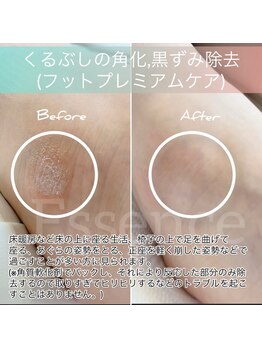 エッセンス (Essence)/フットプレミアムケア