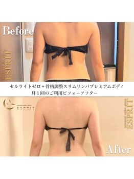 エスプリ 新宿店/月一痩身エステでリバウンドなし