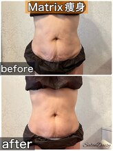 サロンデイジー(Salon Daisy)/Matrix痩身★施術一回
