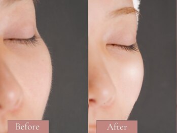 リル バイ アンドアール(Rire by and.R)の写真/韓国肌になれるフェイシャルWax《韓国美肌wax》でくすみ、毛穴悩みをケア★一緒に素肌美人を目指しましょう