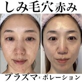 トータルエステティック ジョワイユ(JOYEUX)