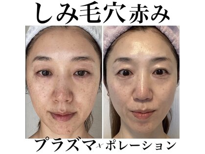 トータルエステティック ジョワイユ(JOYEUX)の写真