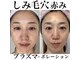 トータルエステティック ジョワイユ(JOYEUX)の写真