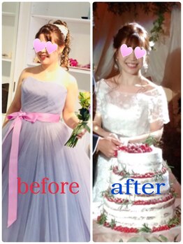 オージャス(OJAS)/【ブライダルエステ】