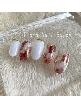 ティアラ(Tiara)/[Hand] 定額コース