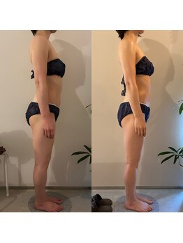 ラナ 京都西院店(Lana)/全身リンパマッサージ