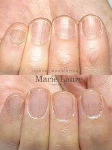 マリーロール 天王寺店(Marie Laure)/深爪矯正/自爪育成/ネイルケア/