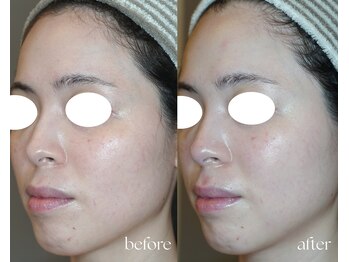 岩川治療院/引き締まり&トーンアップ♪