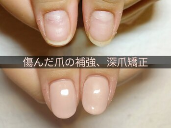 マニエネイル(mani e nail)/傷んだ爪の補強に、深爪矯正