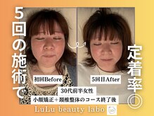 ルルラボ(LuLu beauty labo)/5回の施術で圧倒的な小顔に！