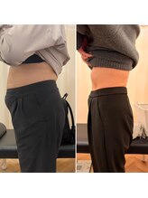 ナオ接骨院(NAO接骨院)/Before／After