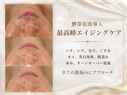 ソアン(Soin)の写真