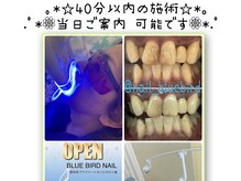 ブルーバードネイル(BLUE BIRD NAIL)の雰囲気（大人気セルフホワイトニング♪当店は5分×2回。医師監修機械です）