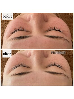 メナードフェイシャルサロン 岐阜茜部/ホワイトニングパック