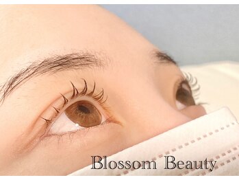 ブロッサムビューティー(Blossom Beauty)/横から見ても可愛く♪