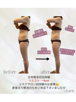 カリス(charis)/全身痩身　初回体験