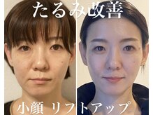 トータルエステティック ジョワイユ(JOYEUX)の雰囲気（最先端美容プラズマシャワー×ジェット/シミくすみ改善/毛穴ケア）